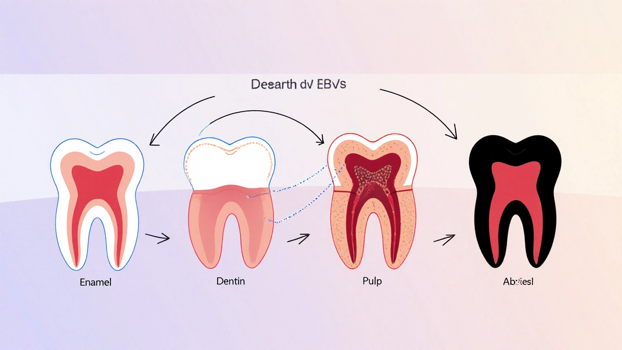 Postupné poškození zubu od zdravého stavu až po absces