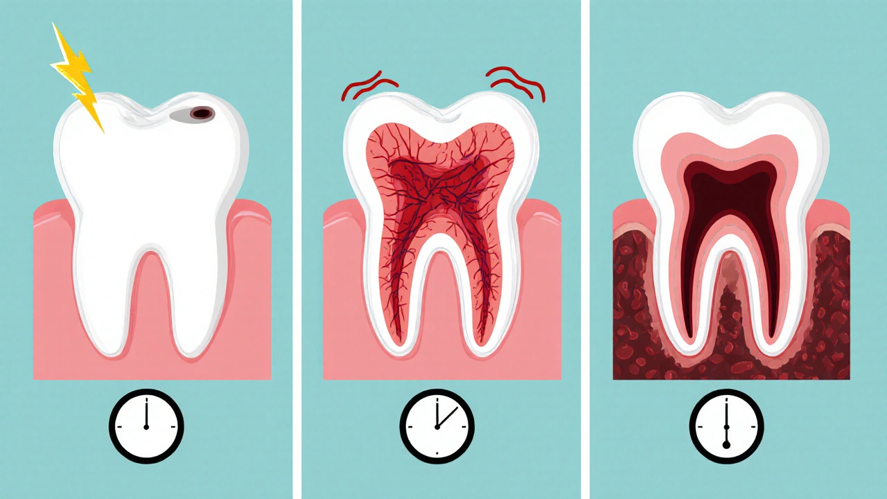 Tři panelové znázornění: první kaz, následná pulpitis a chronický abscess.