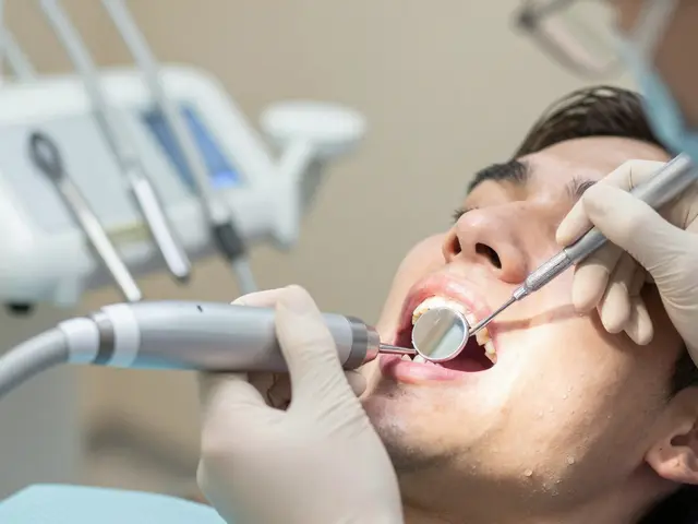 Odstranění zubního kamene: Jak se připravit a co očekávat