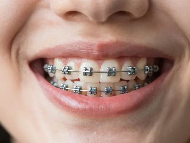 5 mýtů o keramických rovnátkách: Pravda vs Fikce - Expertní odpovědi