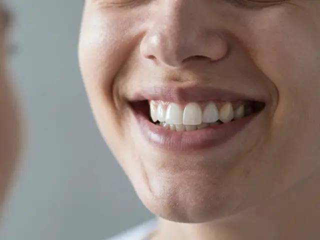 Celokeramické fazety versus bělení zubů: Co je lepší pro vaši úsměv?