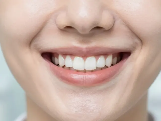 Alternativy k fazetám na přední zuby: Které řešení vybrat pro krásný úsměv?
