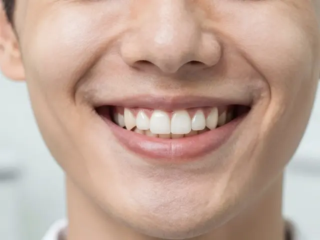 Fazety na přední zuby: Vše, co potřebujete vědět před první návštěvou