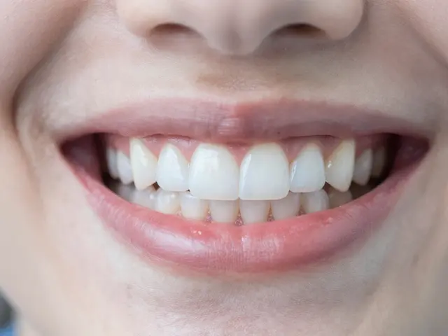 Fazety na zuby vs. bělení: Která cesta k bílému úsměvu je pro vás ta pravá?