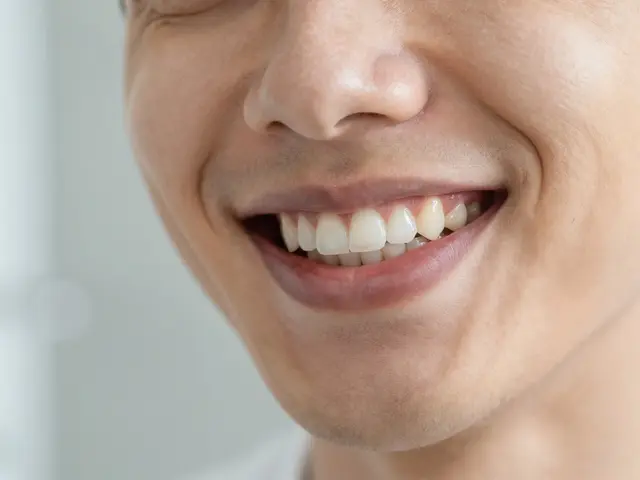 Jak se zbavit mezery mezi zuby: Možnosti a moderní metody