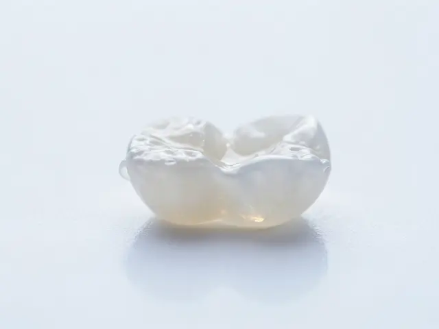 Keramické fazety: Cesta k dokonalému úsměvu a jejich cena