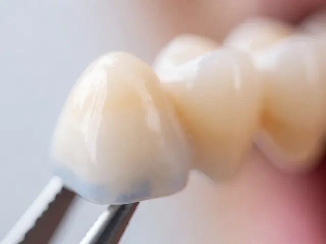 Jak vypadá zubní protéza? Průvodce vzhledem a materiály